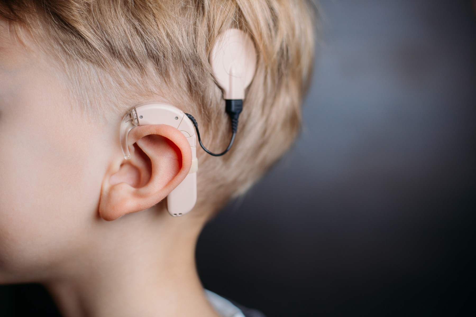 https://content.presspage.com/uploads/2478/1920_cochlearimplantstoryphoto--shutterstock.jpg?10000=